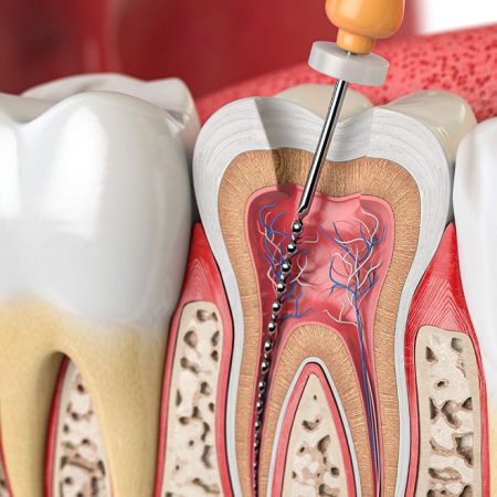 Endodontie